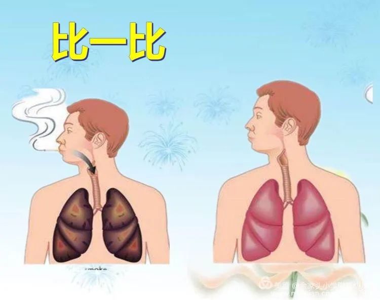 世界无烟日宣传教育海报（10张）-图9