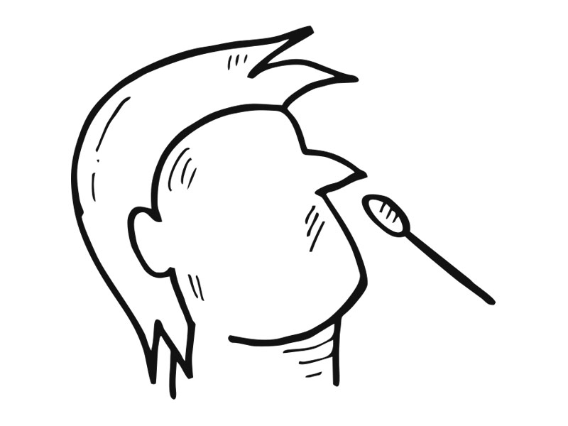 步骤7：抗原体检测