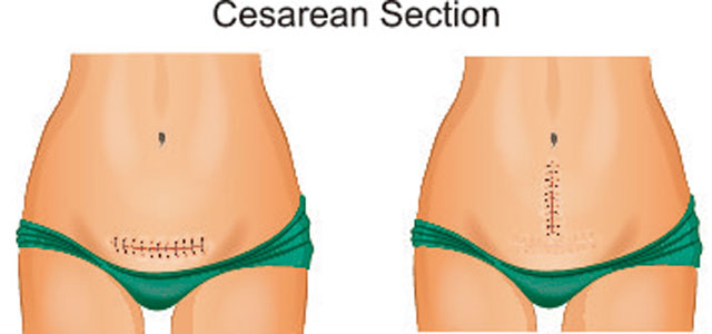 春雨医生 春雨医生