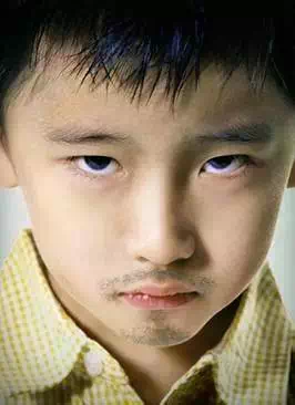 天呐!好好的孩子,怎么突然斜视了呢?