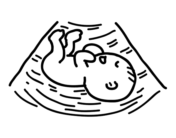 超声胎儿影像彩页